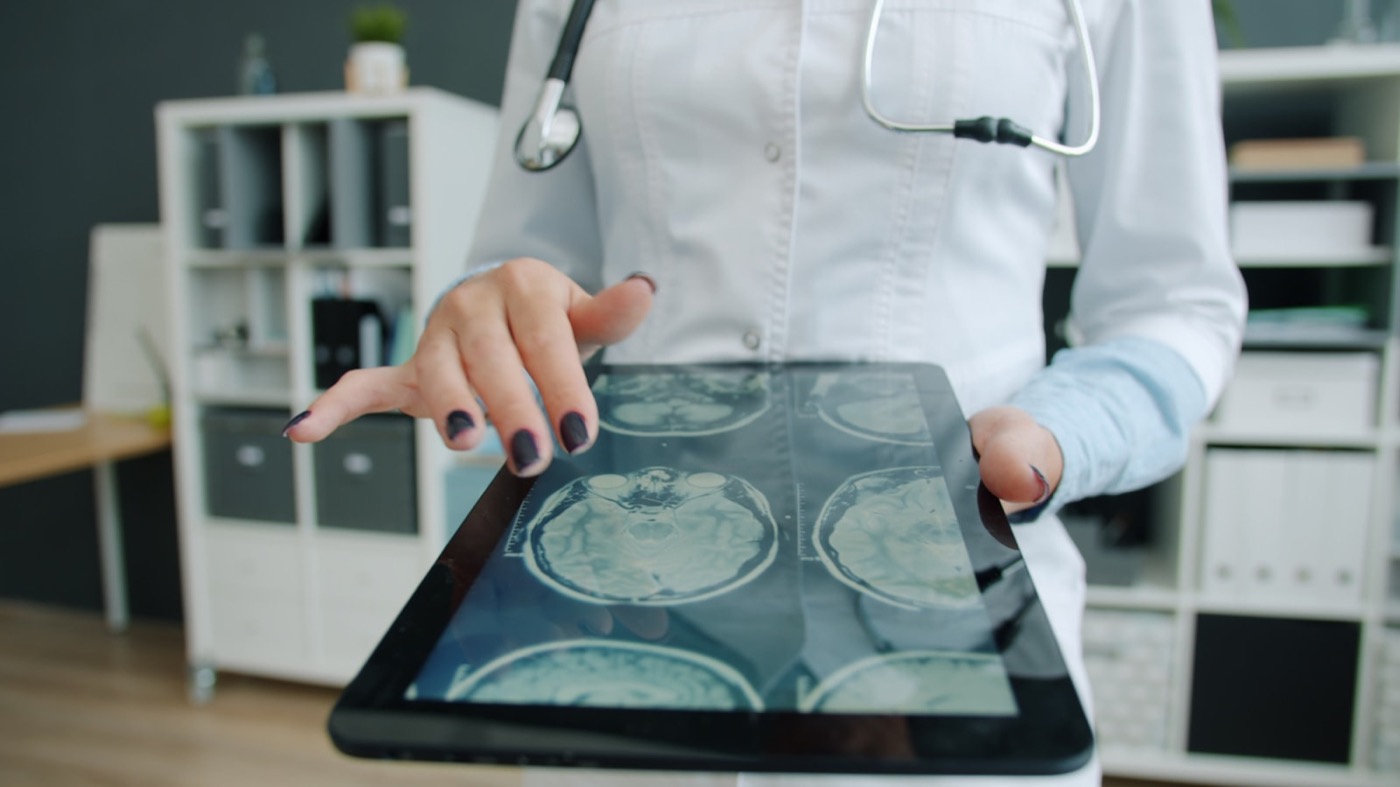 แพทย์เปิดดูภาพสแกน MRI ผ่านระบบ PACS ที่เชื่อมต่อคลาวด์โรงพยาบาล